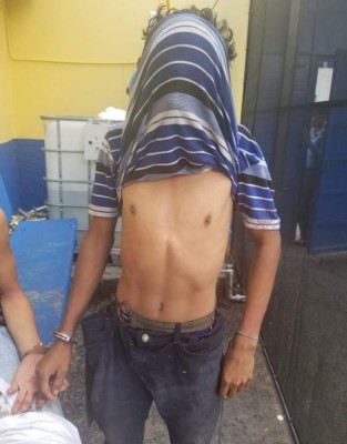 Golpeados y atados de pies y manos fueron entregados tres presuntos ladrones a la Policía (Fotos)