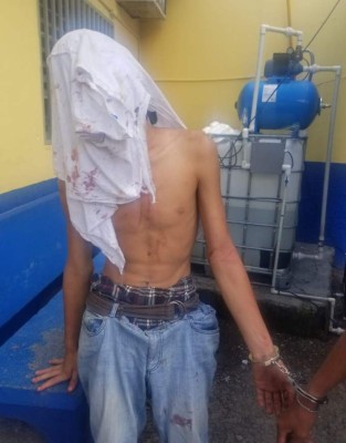 Golpeados y atados de pies y manos fueron entregados tres presuntos ladrones a la Policía (Fotos)