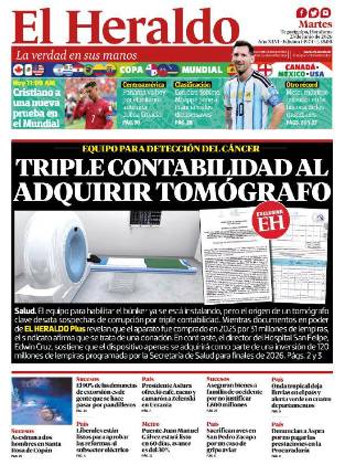 Triple contabilidad al adquirir tomógrafó en el San Felipe