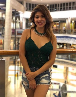 Naela, la cantante colombiana que sufrió 47 fracturas en su rostro