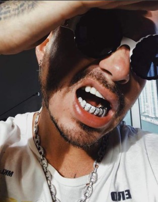 J Balvin presume ostentosos grills dentales ¿cuánto gastó?
