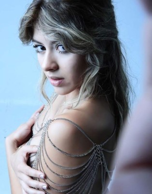 Naela, la cantante colombiana que sufrió 47 fracturas en su rostro