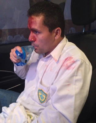 Agreden a candidato a alcalde del Pac