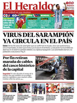 Virus del sarampión ya circula en el país