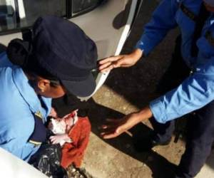Miembros de la Policía Nacional le brindaron los primeros auxilios al pequeño.