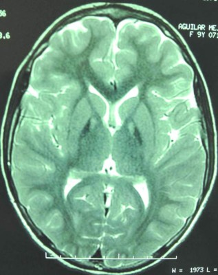 Ojo de tigre, el signo de la afección que cambió la vida Sabini Nicol