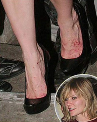 Las 10 famosas con los pies más feos