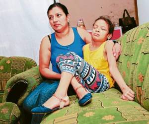 La pequeña Sabini Nicol continuará con su atención en el IHSS.