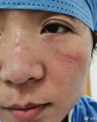 Impactantes fotos muestran estragos del coronavirus en personal médico