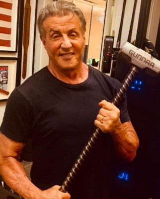 Antes y después de famosos que desfiguraron sus rostros con cirugías