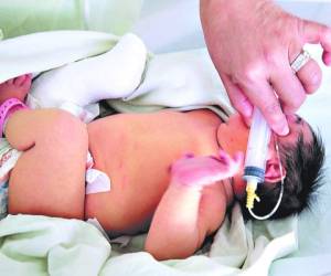 De los ocho bebés que nacieron esta semana con microcefalia en Choluteca, dos están siendo atendidos en el Hospital Escuela Universitario de Tegucigalpa, tal y como lo confirmó EL HERALDO.