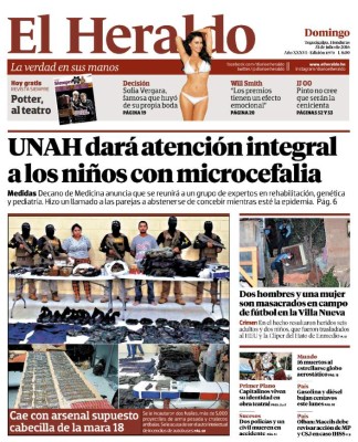 UNAH dará atención integral a los niños con microcefalia