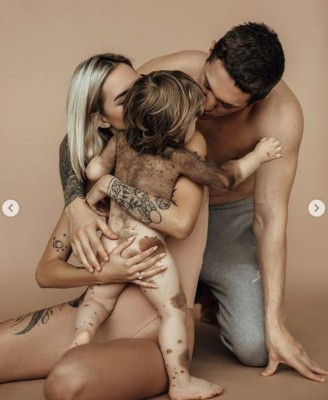 Influencer rusa causa polémica por mostrar a su bebé con rara enfermedad