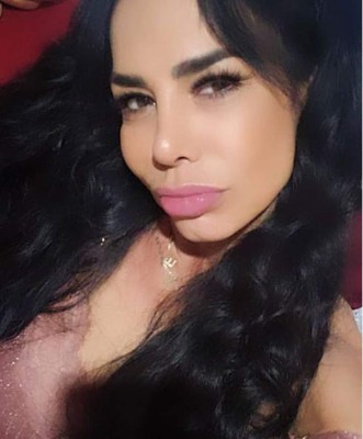 FOTOS: Lis Vega y su radical transformación física tras varias cirugías