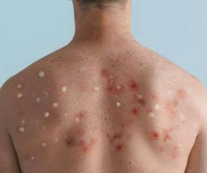 Las personas infectadas no deben de mantener contacto directo con amigos ni familiares, ni prestar sus utensilios personales, deben de tener una baño privado y usar la mascarilla constantemente.