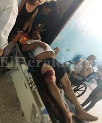 Dos heridos en violenta protesta de obreros en carretera a Orocuina, al sur de Honduras