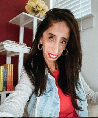 La inspiradora historia detrás de Lizzie Velásquez, la 'mujer más fea del mundo'