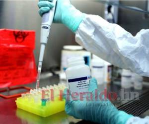 Actualmente, Honduras no está practicando pruebas PCR a la población.