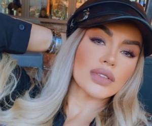 Mariana González es conocida como la Kim Kardashian mexicana debido a sus múltiples cirugías. Foto: Cortesía.