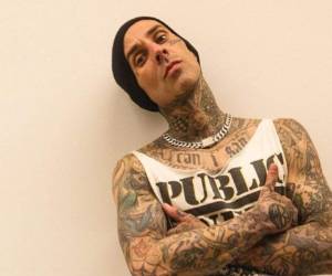 El músico tuvo un largo camino para recuperarse tanto mental como físicamente después del trágico accidente aéreo.