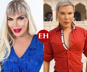 Rodrigo Alves, mejor conocido como el Ken humano, volvió a la sala de operaciones y ahora salió convertido en una Barbie. Conoce cuáles fueron sus razones en la siguiente galería. Fotos: Cortesía @rodrigoalvesuk.