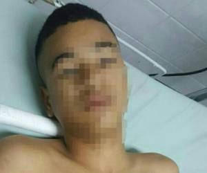 El menor de 14 años permanece hospitalizado tras resultar herido en un operativo en el cual le frustraron un intento de extorsión, informó la Fuerza Nacional Antiextorsión (FNA).
