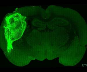 Una imagen sin fecha publicada por la Universidad de Standford el 12 de octubre de 2022 muestra el cerebro de una rata en la que se ha utilizado una proteína fluorescente para resaltar las células cerebrales humanas trasplantadas.
