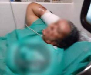 La señora afectada rápidamente fue atendida en Puerto Cortés, pero debido a las lesiones será trasladada al Hospital Escuela.