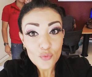 La guapa mujer se realizaba una liposucción cuando perdió la vida. Foto: Twitter