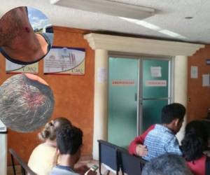 Tres docentes resultaron heridos durante los desalojos.