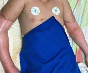 El menor fue trasladado desde Copán el pasado 6 de noviembre. Foto: EL HERALDO