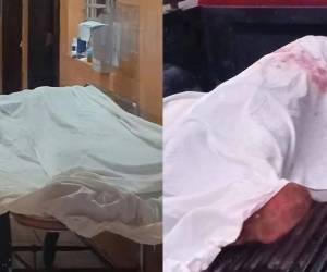 De acuerdo con información preliminar, ambas víctimas se encontraban en estado de ebriedad cuando iniciaron una acalorada discusión que rápidamente escaló a los golpes.