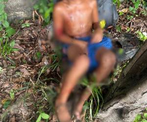En la foto figura uno de los menores, él sufrió graves mordeduras en una de sus piernas y también se le ven lesiones en sus brazos.