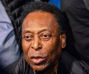 El triple campeón del mundo (1958, 1962, 1970), de 78 años, se encontraba en la capital francesa cumpliendo compromisos publicitarios a principios de abril cuando fue internado debido a una infección urinaria. Foto:AFP