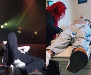 Bad Bunny se mostró preocupado por el intenso dolor que sufrió y tuvo cancelar sus próximos conciertos. Fotos Instagram @badbunnypr