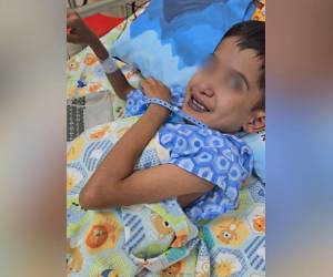 La primera intervención al corazón del menor Josué Cruz fue exitosa, confirmaron familiares.