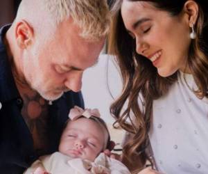 La pareja confesó que su hija nació con paladar hendido y que será operada a su tiempo. Foto: Instagram