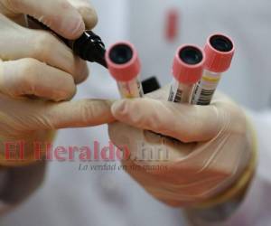 Para entrar a Honduras es obligatorio tener una prueba de covid-19 negativa. Foto: EL HERALDO/ AFP