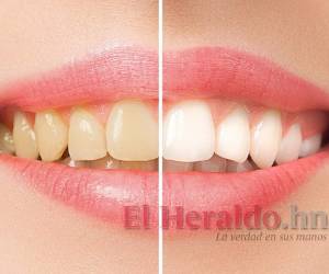 Se recomienda empapar el cepillo con enjuague bucal antibacterial tras su uso. Foto Canva