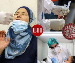 Desde que se confirmó el primer caso de flurona en el mundo, son muchos los que se preguntan si la pandemia está lejos de llegar a su fin.Por el momento, lo que se sabe es que esta infección ha sido detectada por primera vez en Israel y se trata de una coinfección por coronavirus y el virus de la gripe. ¿Cuáles son sus síntomas? Esto es lo que debes de saber. Fotos: EL HERALDO y AP