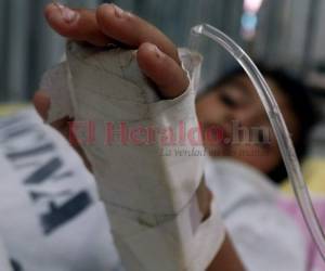 La epidemia de dengue se ensañó más este año con los menores de 15 años de edad.