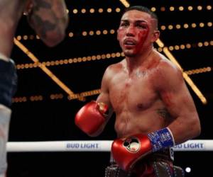 Teófimo López conmocionó al mundo al terminar con su rostro ensangrentado en su combate ante el australiano George Kambosos. Foto: AFP