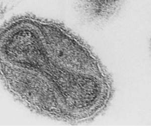 Imagen de referencia de virus visto desde un microscopio.
