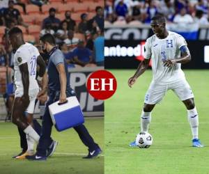 Las alarmas se han vuelto a encender en la concentración de Honduras en la Copa Oro ante las nuevas lesiones dentro del plantel. Fotos: Grupo OPSA | AP