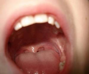 La lengua interviene en el gusto, masticación y deglusión de los alimentos.