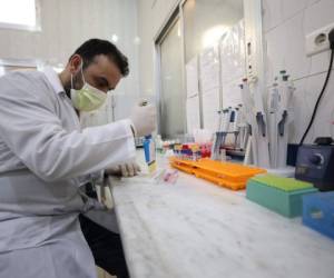 A Syrian doctor works at the EWARN laboratory set up for the early detection of coronavirus cases in rebel-held Idlib, in northwestern Syria, on March 25, 2020. - The virus is the latest threat to the three million people who live in Idlib, many of whom are now reduced to living in camps without basic amenities in Syria's last major rebel bastion, where a fragile truce has largely halted the government's bombardment since the start of the month. (Photo by OMAR HAJ KADOUR / AFP)