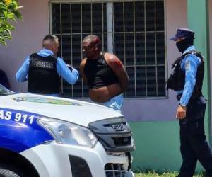 De acuerdo con la defensa legal del togado, su cliente fue víctima de varios golpes por parte de agentes policiales al momento de su detención.