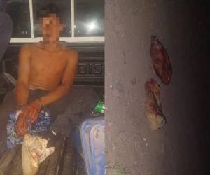 Un joven fue capturado por ser sospechoso de asesinar a pedradas a otro hombre en San Francisco de La Paz, Olancho.