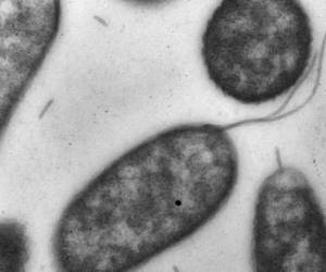 A la bacteria se le conoce como 'come carne' porque la infección en la sangre produce lesiones en la piel con ampollas, además de fiebre, escalofríos y presión baja.