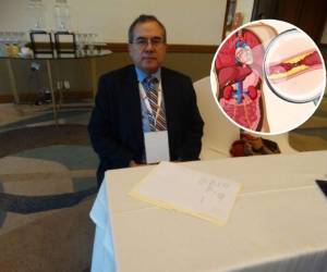 El Presidente de la Asociación Hondureña de Prevención de la Aterosclerosis, AHDEPA, Fausto Muñoz Lara, dijo que la actividad lleva como fin educar a la población hondureña para que sepan cómo prevenir una de las causas más graves y frecuentes de complicaciones severas en la salud.